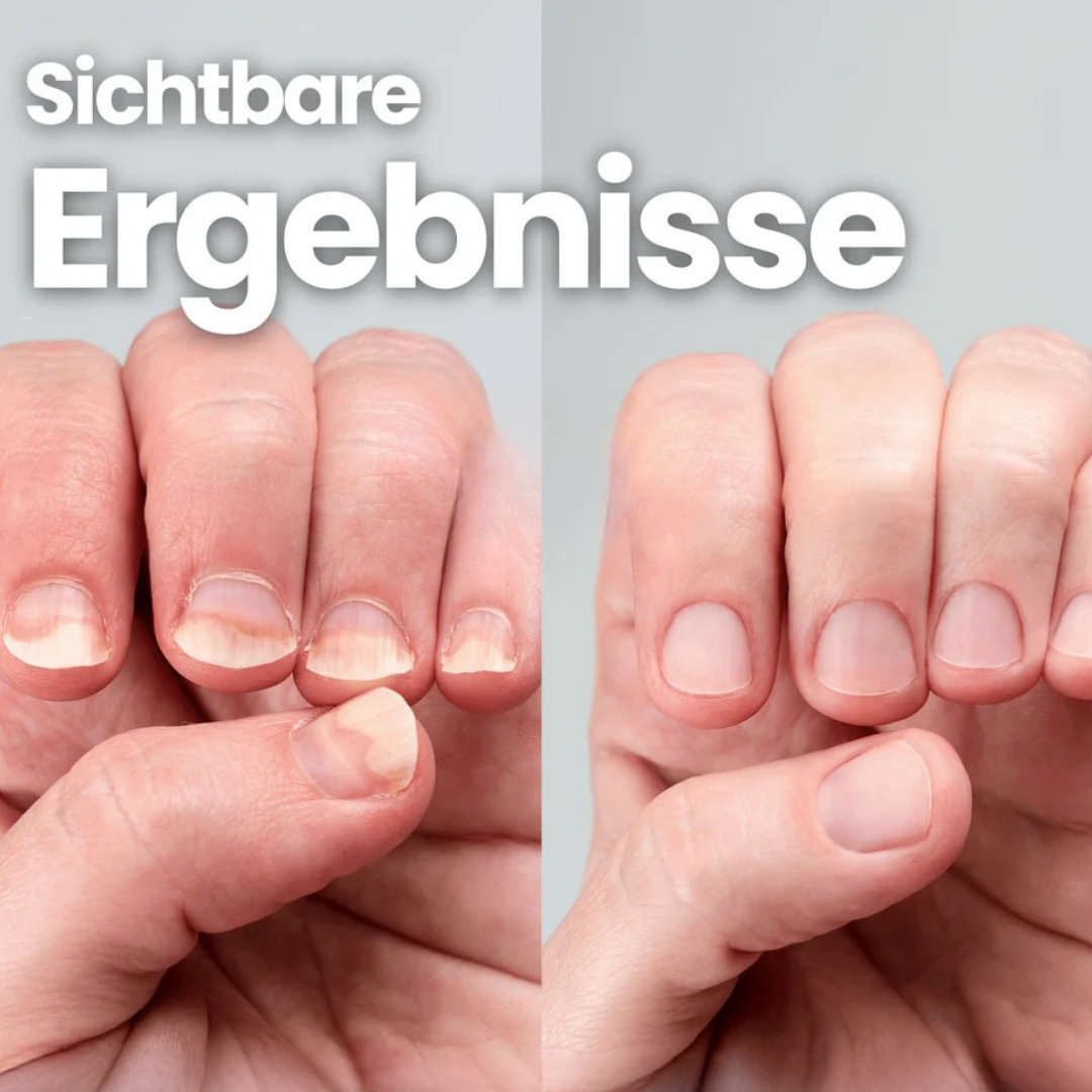 Nagelstrahl® - NagelMed Pro